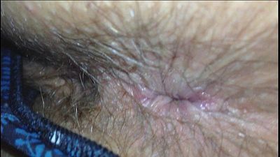 Wife Shit Stained Hairy Arsehole Inspection - 3 min